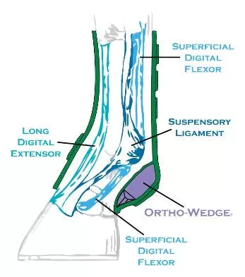 Iconoclast Orthopedic Boot- Front